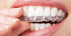 a woman using an alternative to braces