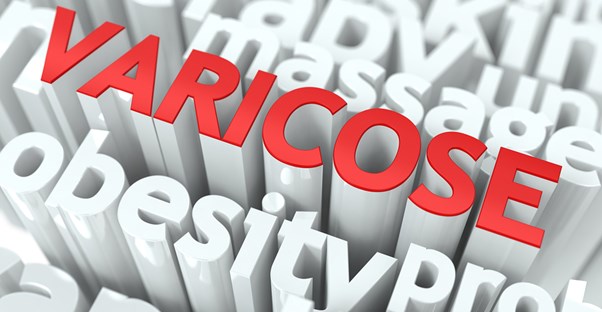 the word varicose veins