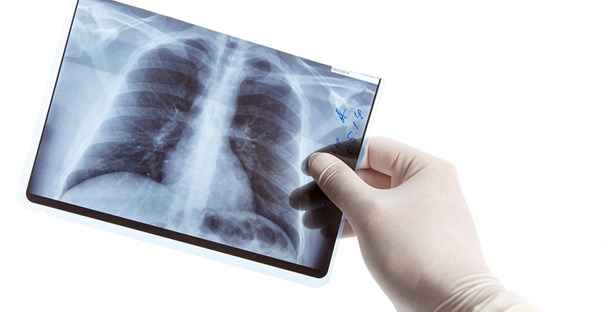 a respiratory therapist examine xray