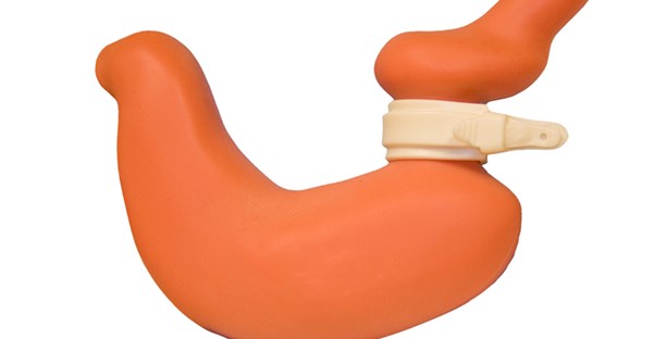 image of a lap band
