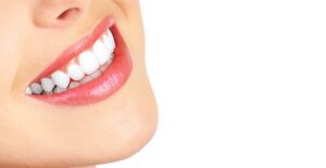 a woman who knows that teeth whitening is for her