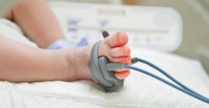 a baby suffering from fetal alcohol syndrome