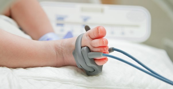 a baby suffering from fetal alcohol syndrome