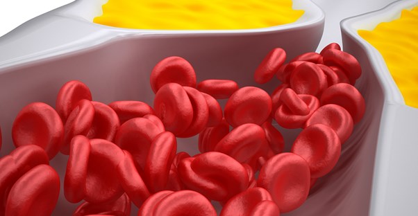 high density lipoprotein