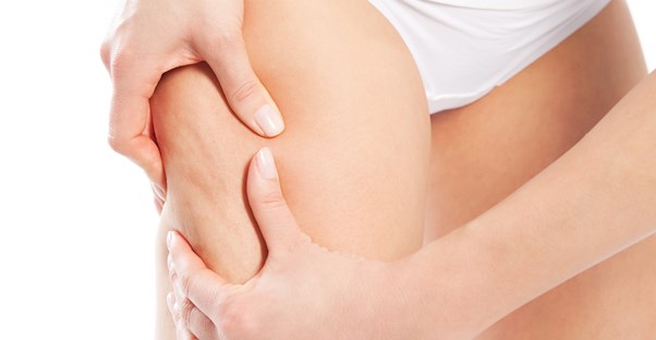 a woman considering exercises that fight stretch marks