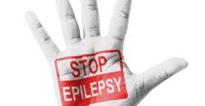 an image that represents seizure prevention