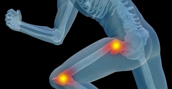 an image of an ACL injury
