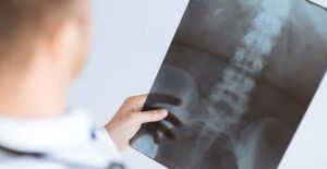 a doctor who is diagnosing Ankylosing Spondylitis