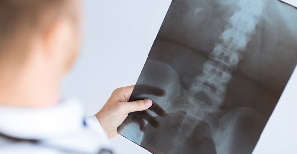 a doctor who is diagnosing Ankylosing Spondylitis