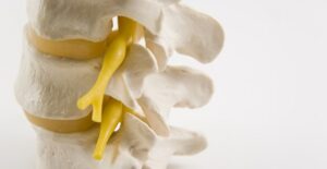 a picture of a spine