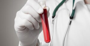 a doctor with a vial of blood