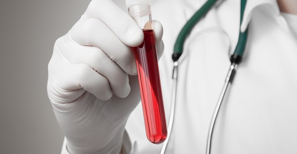 a doctor with a vial of blood