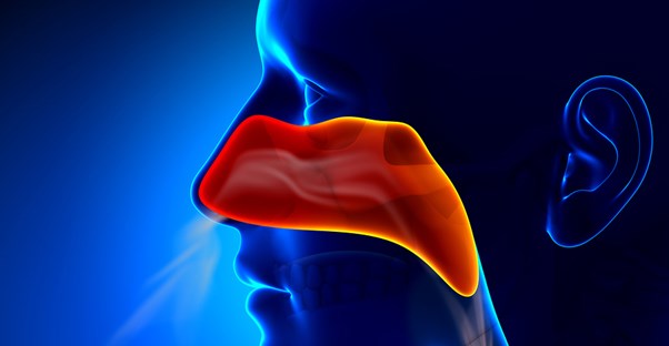 a diagram of acute sinusitis