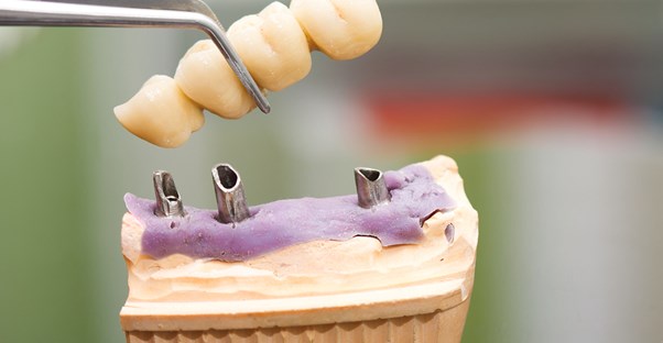 a dentist practicing to install dentures