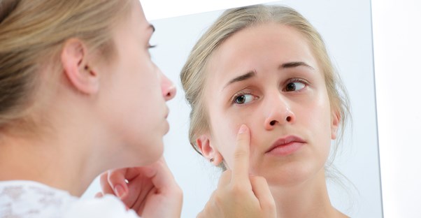 a woman who plans to discuss acne with her dermatologist