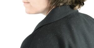a woman suffering from dandruff