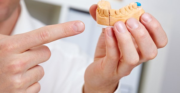 a man who knows the cost of dental implants
