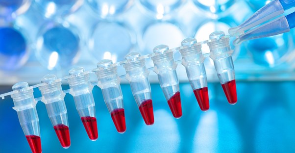 equipment used in paternity testing