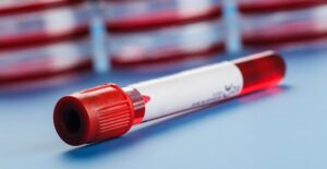 a vial used in DNA testing