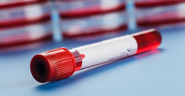 a vial used in DNA testing