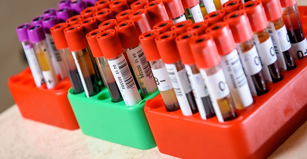 equipment used to diagnose hemophilia
