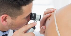 a doctor about to prescribe melanoma treatments