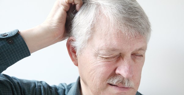 a man suffering from scalp psoriasis