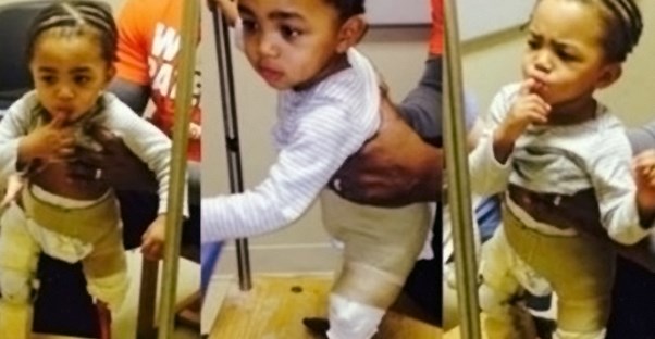 Kayden Kinckle walks with prostheses