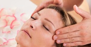 a woman undergoing acupuncture for weight loss