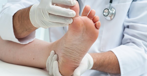 a foot affected by ringworm