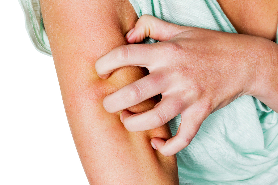 How do you get ringworm?