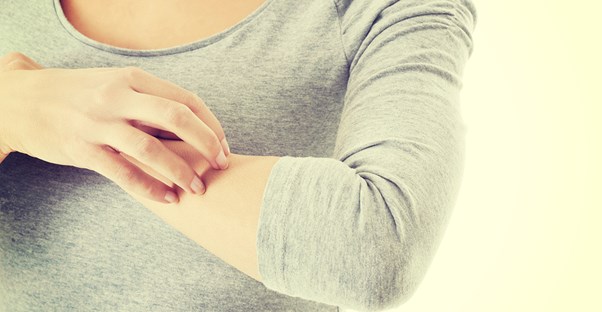 A woman checking a rash on her arm