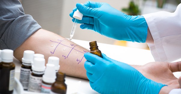 A doctor tests for the causes of a patient's hives