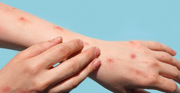 two arms with red dots