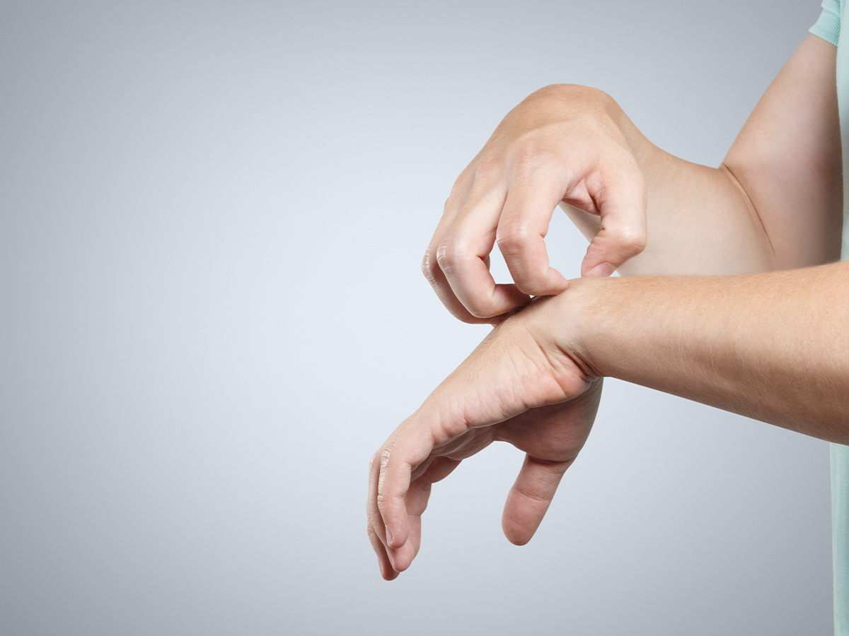 Adult Chickenpox Treatments