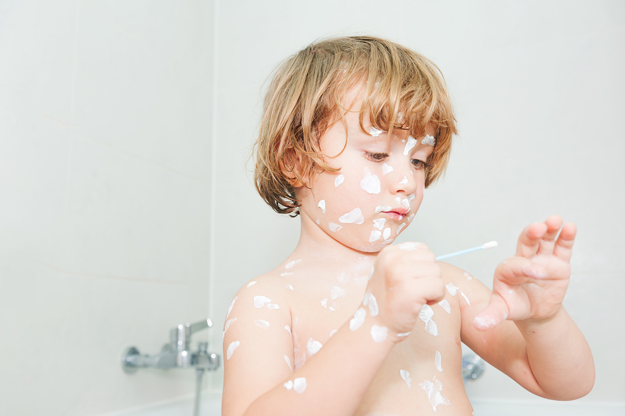 Child Chickenpox Treatments