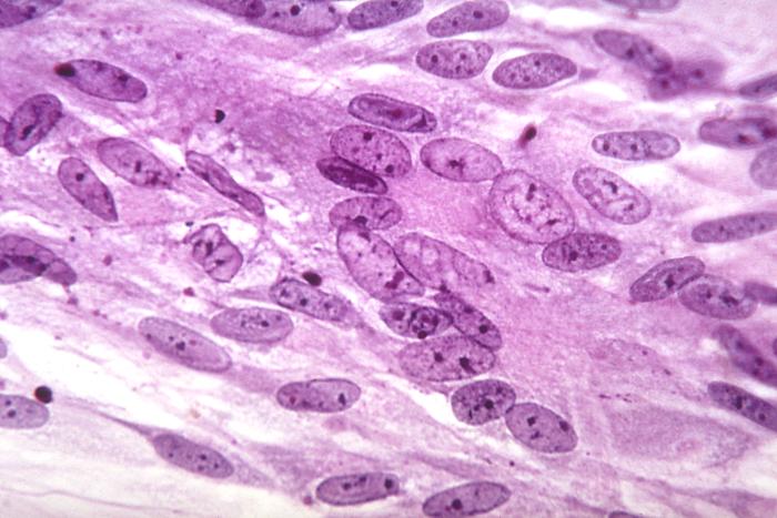 Chickenpox and Shingles Causes