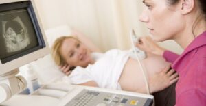 a nurse who knows what causes cleft palate