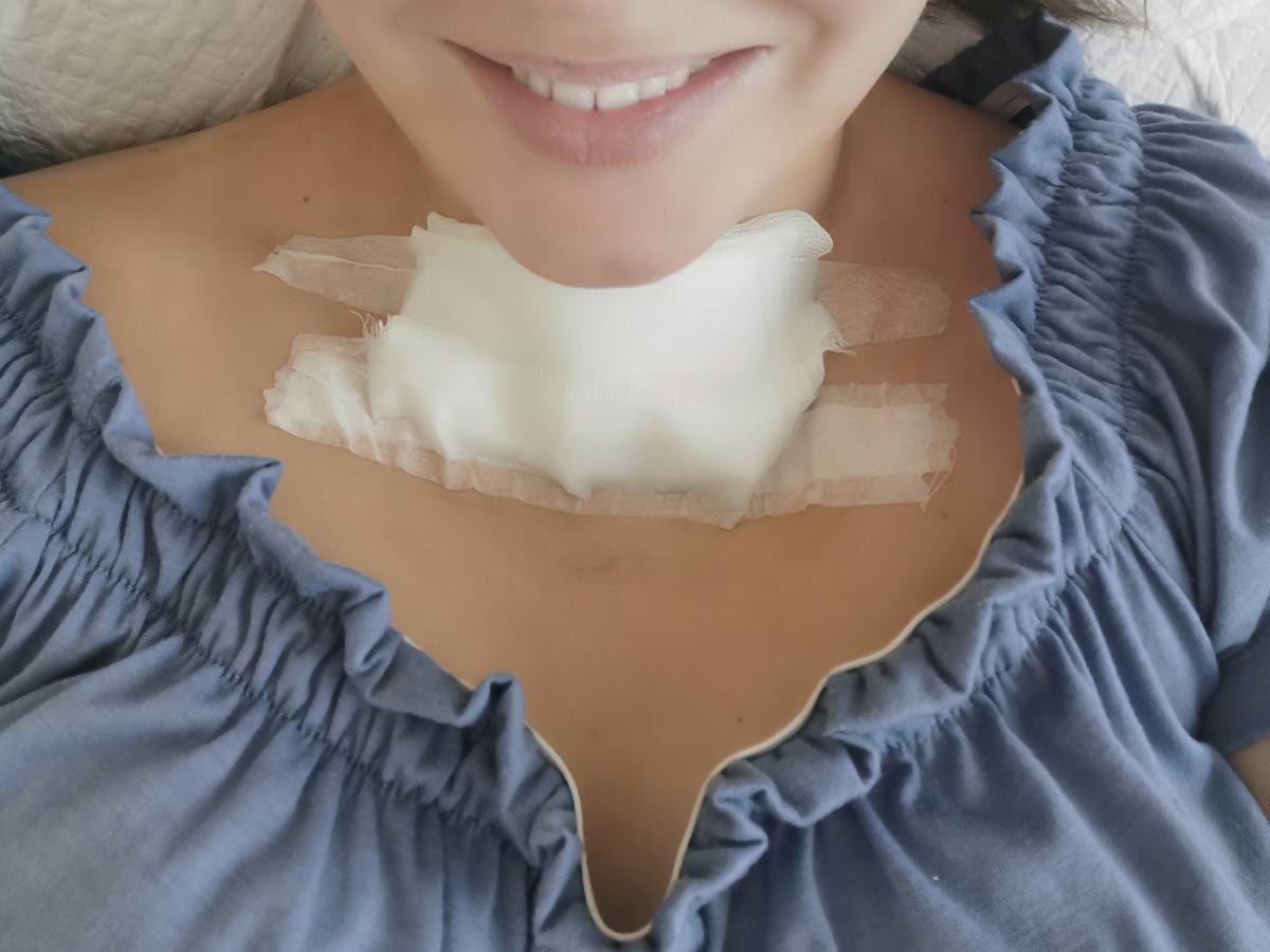 Thyroid Removal Surgery