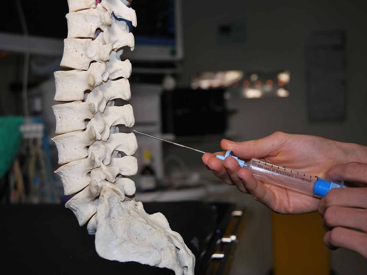 Epidural Steroid Injections