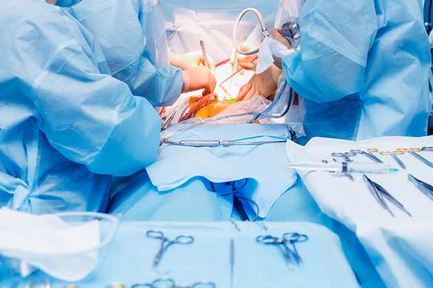 Laparotomy
