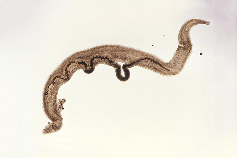 Schistosomiasis