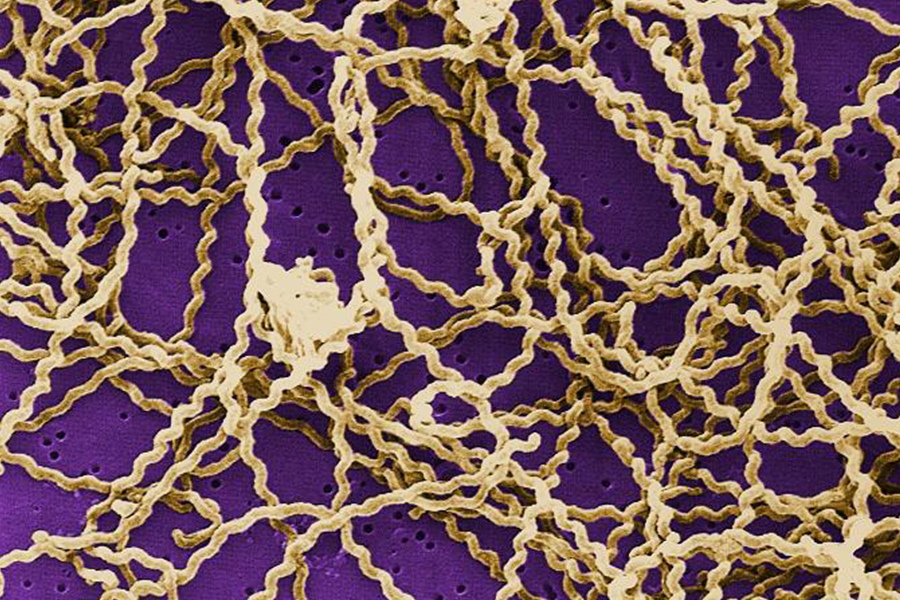 Leptospirosis