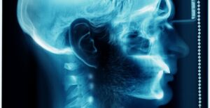 How to prevent whiplash