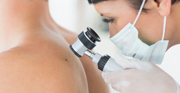 A dermatologist checks out a funky mole