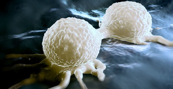 Staging uterine cancer