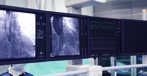 Different types of stents
