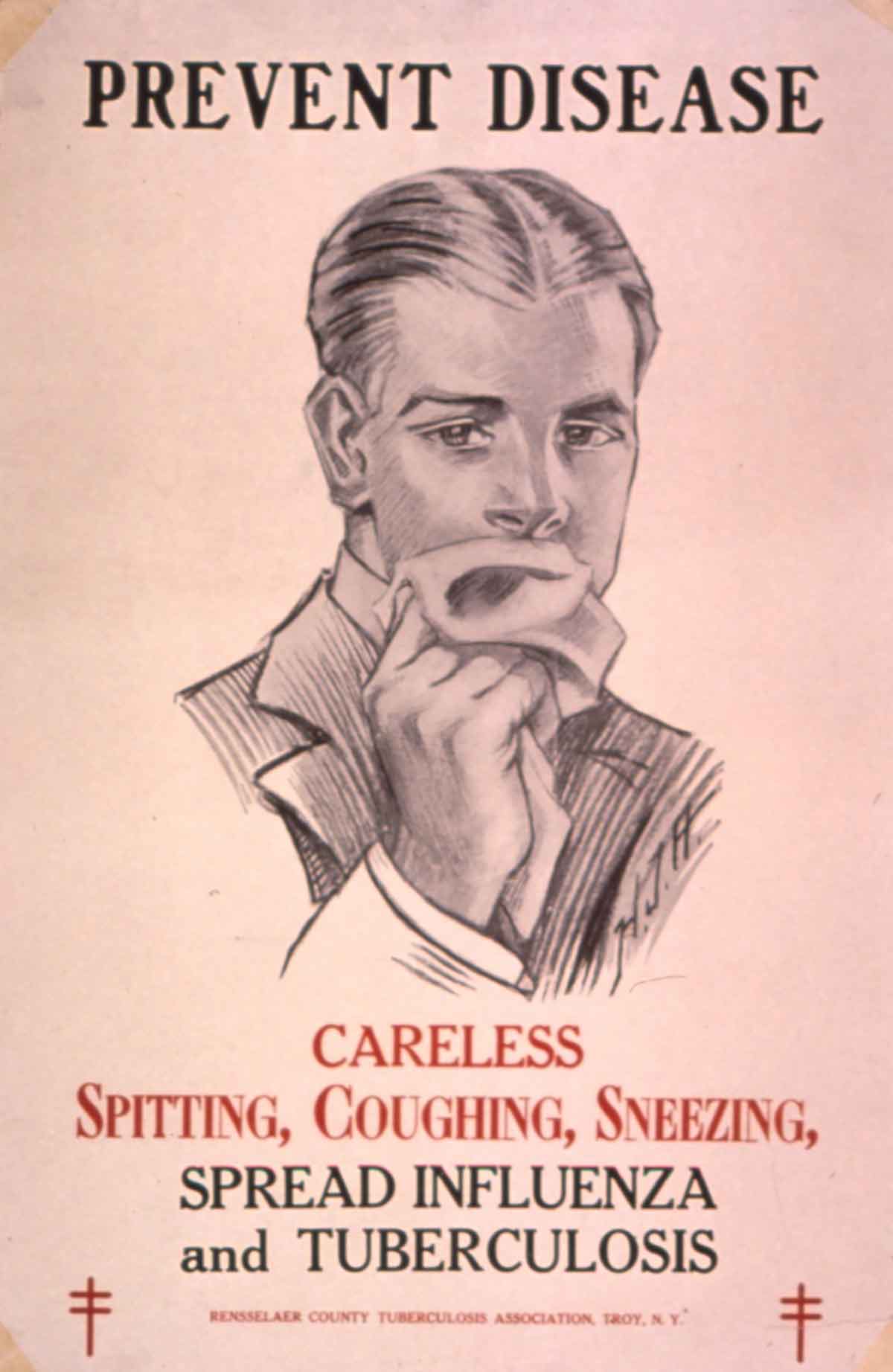 Tuberculosis