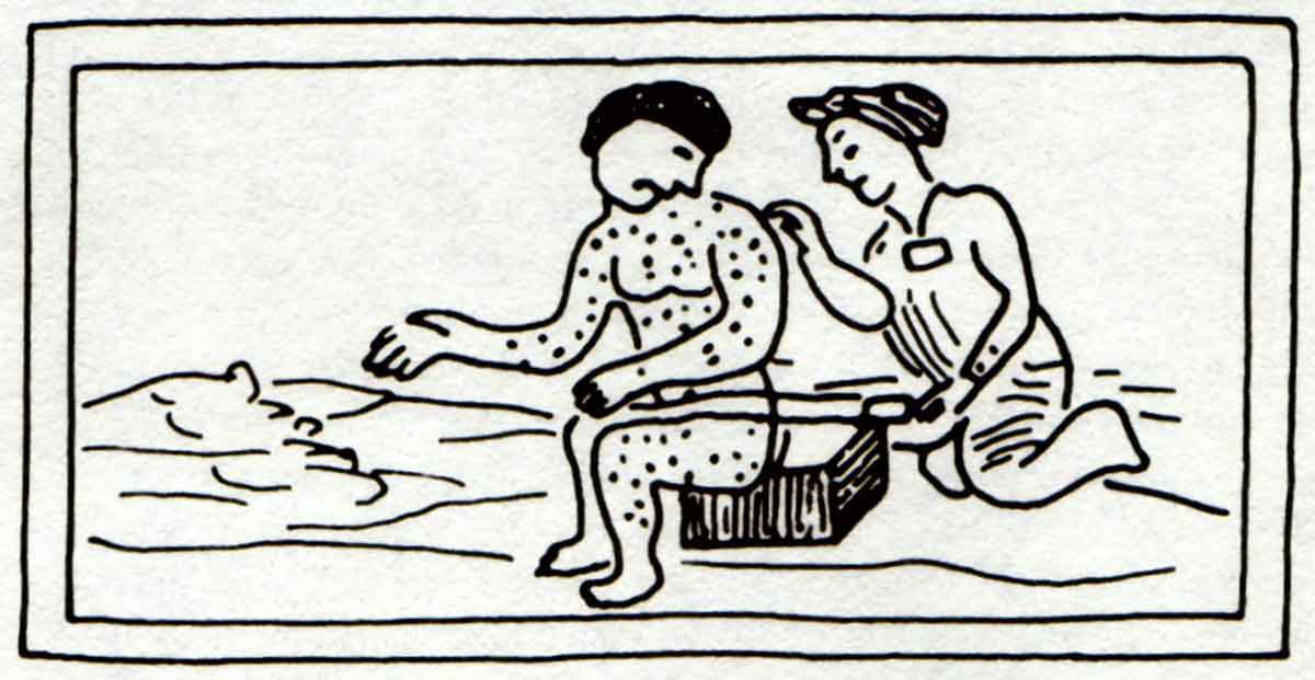 Measles