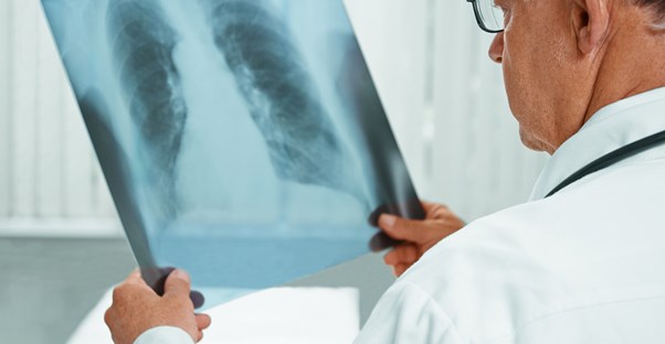 A doctor examines an x-ray